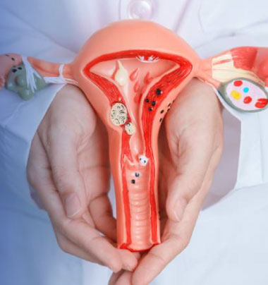 patologia-endometrosis-img01